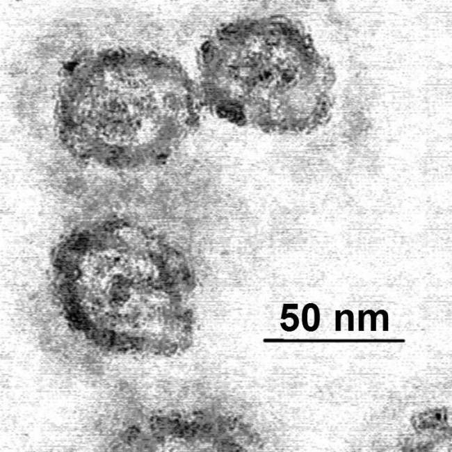 virus de la hepatitis C