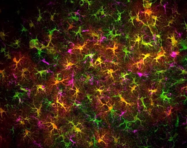 Imagen de astrocitos