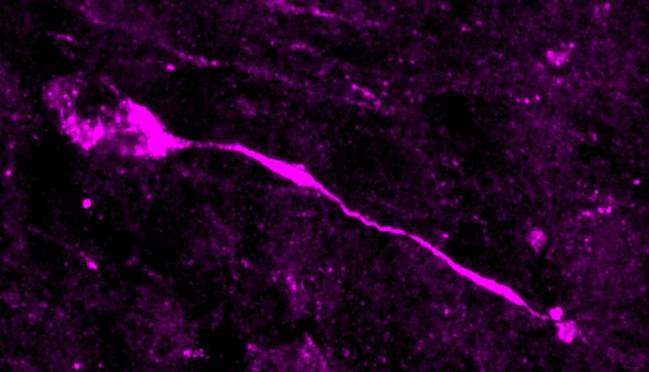  célula glial radial basal en división