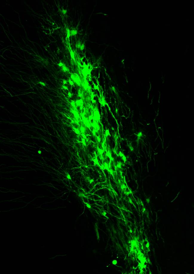 Implante en el que se aprecian múltiples células progenitoras neurales