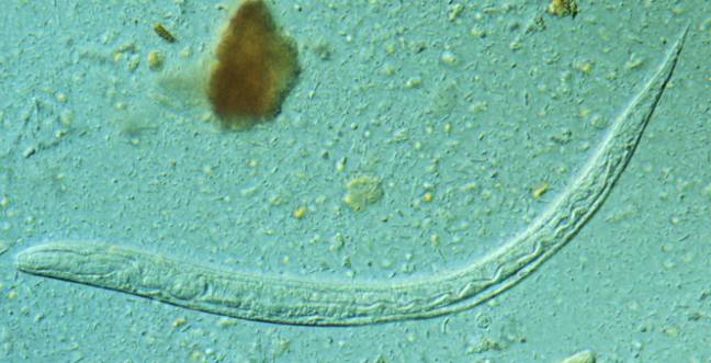 larva de Strongyloides stercoralis