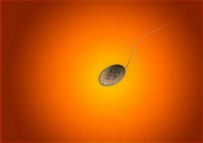imagen que ilustra un espermatozoide