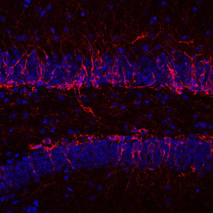 Mutaciones en una proteína inducen depresión