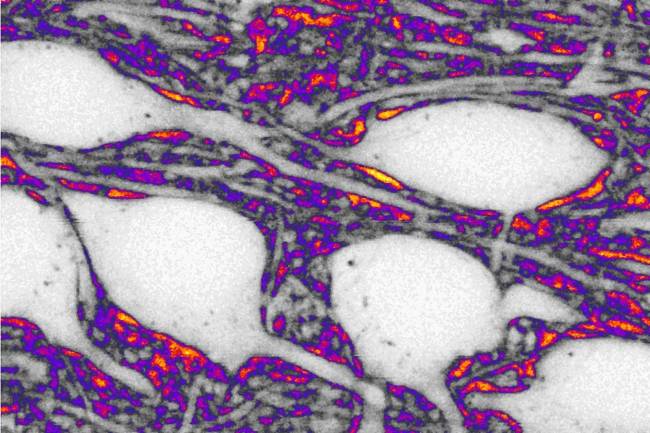 Espacio entre las neuronas. /Jan Tonnesen