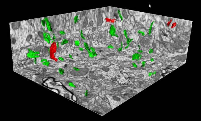 Reconstrucción tridimensional de las sinapsis
