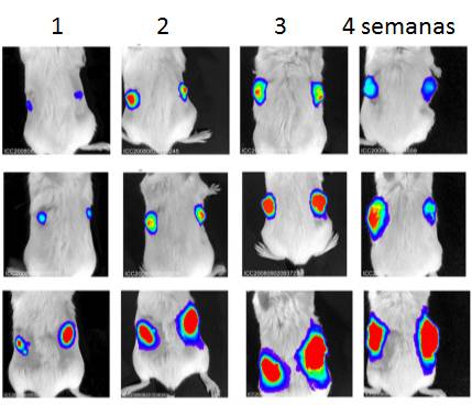Nuevas dianas terapéuticas para el cáncer colorrectal