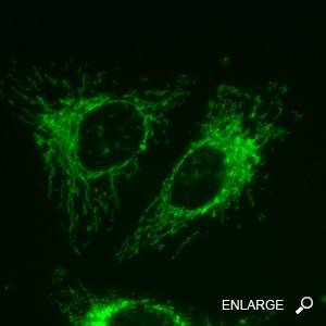 Nuevos avances en el tratamiento de la Neuropatía Óptica Hereditaria de Leber