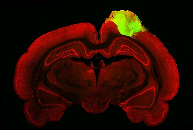 organoide cerebral humano injertado