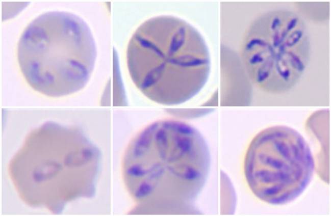 morfología de diversas etapas características del desarrollo de 'Babesia hegotelforum'