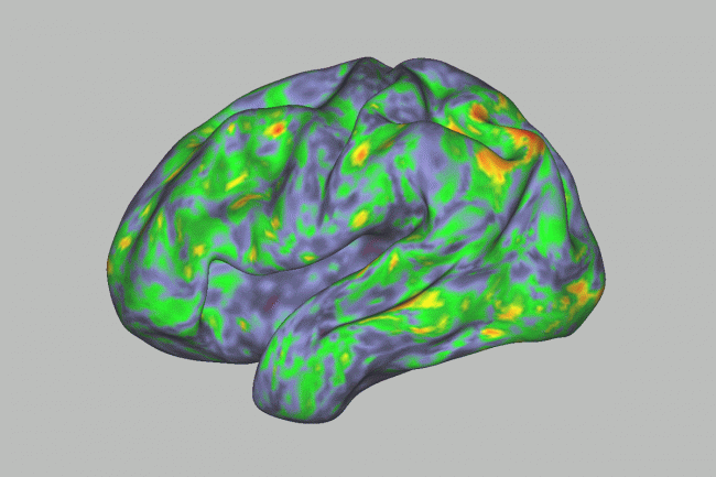 Mapa del cerebro con la toma de psilocibina