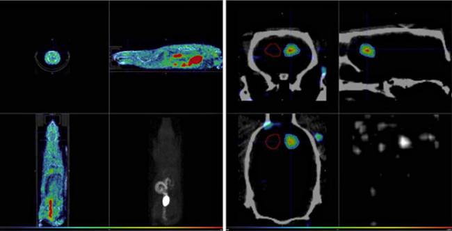 Imagen PET/CT (CNA)