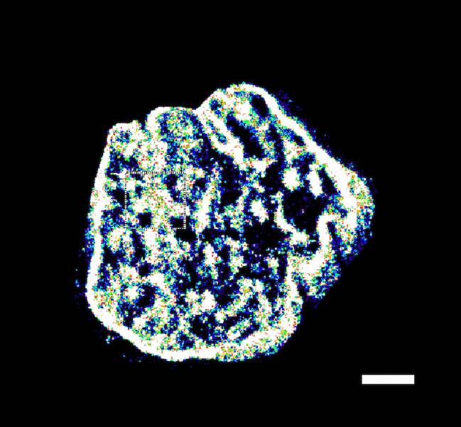 Imagen microscópica de las sondas fluorescentes