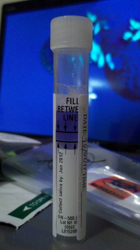     Test de saliva. Imagen: UGR.  