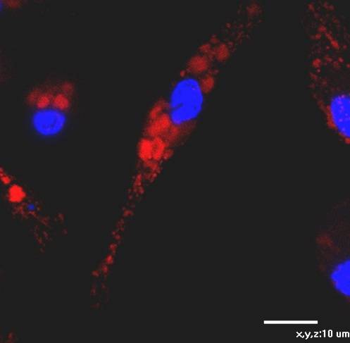 Leishmania emitiendo fluorescencia roja