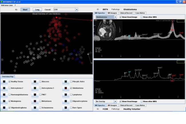 Software AIDTumour