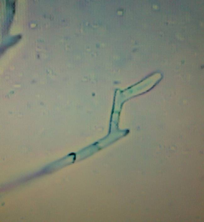 Investigadores del Campus de Palencia creen que el coleóptero ‘Tomicus piniperda’, una especie de barrenillo, contribuiría a dispersar ‘Fusarium circinatum’