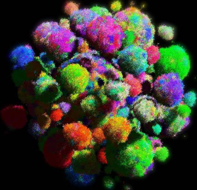 Imagen de modelo tridimensional de un tumor