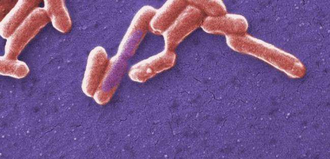 E. coli.