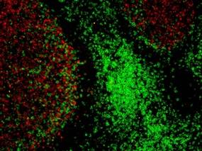 Las técnicas de análisis de imágenes biológicas (bioimaging) permiten abordar problemas de difícil aproximación en ciencias de la vida.