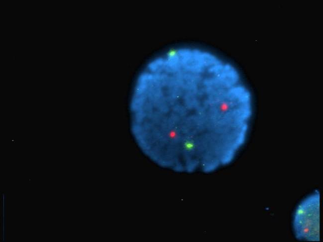 Desarrollan un biosensor que detecta de forma rápida mutaciones genéticas