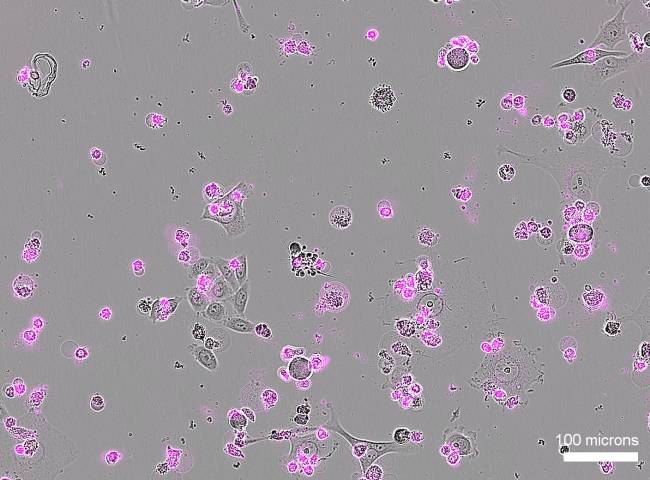 Muerte celular generalizada tras el tratamiento con CRISPR Cas12a2