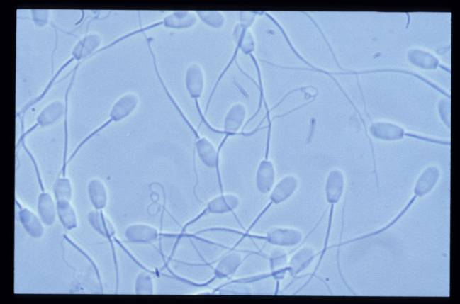 Una muestra al microscopio de espermatozoides empleados