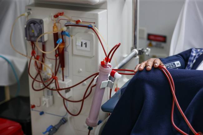 Nueve meses sin diálisis gracias a un riñón de cerdo trasplantado
