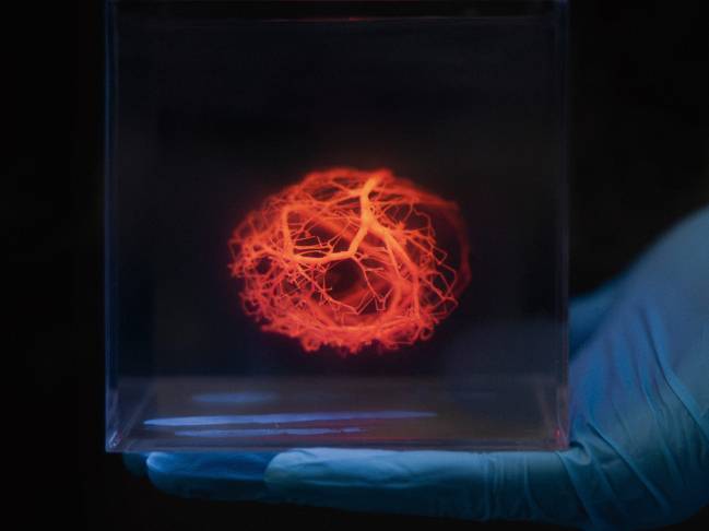 vasos sanguíneos sintéticos, órganos artificiales