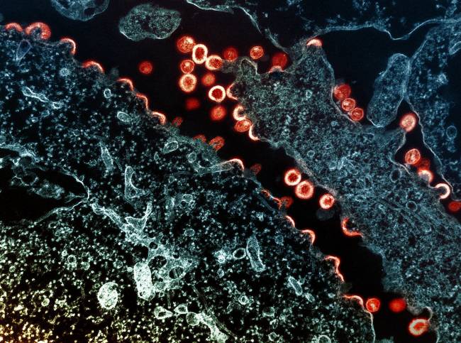 virus VIH-1