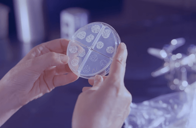 Mano con guante cogiendo una placa con bacterias. 
