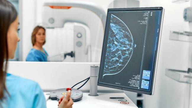 diagnostico mamografía