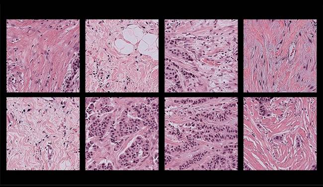 Imágenes patológicas de muestras de tejido humano