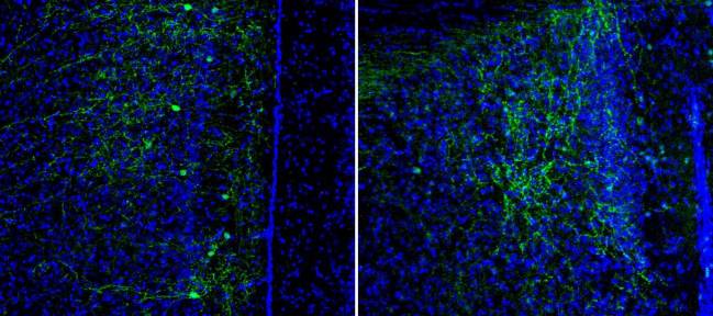 Neuronas CRH+