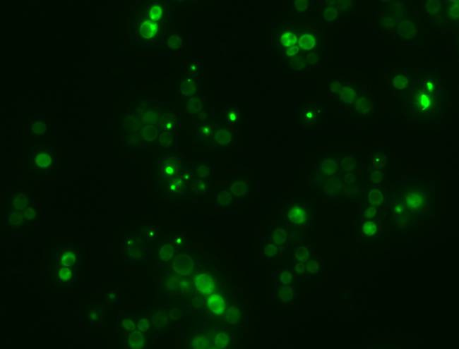 Agregados amiloides, proteínas 
