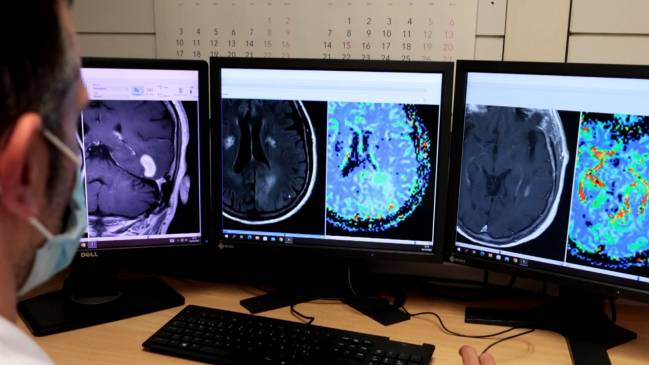 Imágenes de resonancia magnética de cerebro