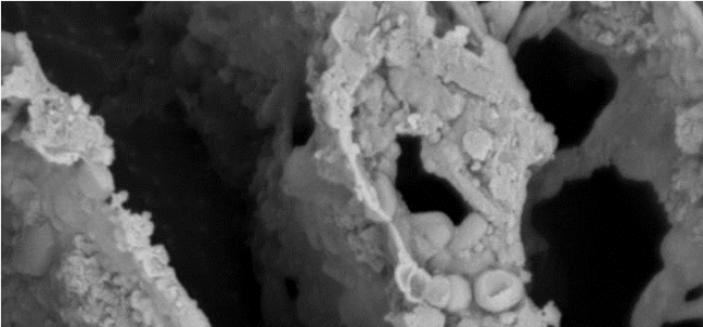 Muestra de microbiota de heces de un individuo sano obtenida mediante microscopio. / CSIC