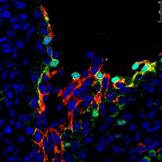 células madre hematopoyéticas