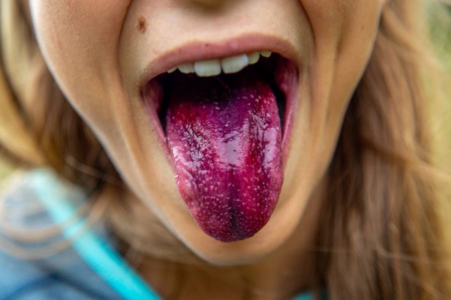 chica con la lengua fuera