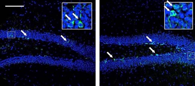 Imagen de microscopía del hipocampo