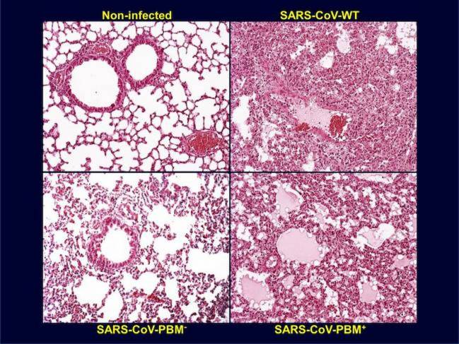 Patología de pulmón de ratones infectados con SARS-CoV con y sin el motivo PBM en la proteína E. / CNB-CSIC | Luis Enjuanes