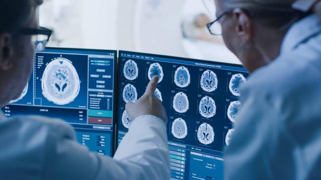 Nanopartículas favorecen la regeneración neuronal en alzhéimer