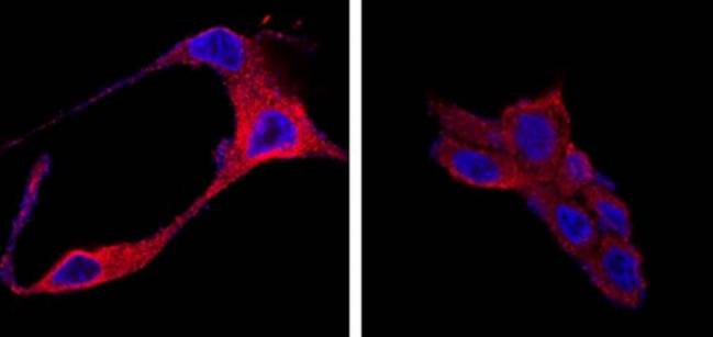 Nanomedicina