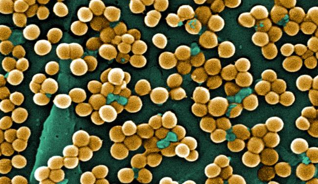 Bacteria ‘Staphylococcus aureus’