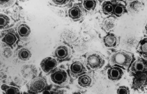 Virus del herpes simple. / CDC | Wikimedia Commons