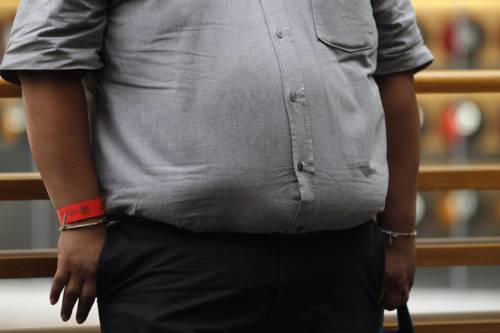 Hombre que padece obesidad