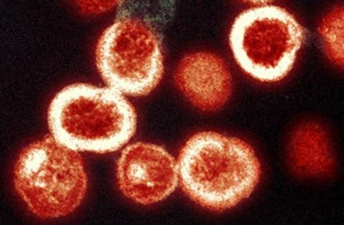 Virus del VIH