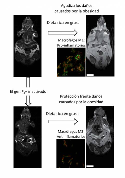 resonancia magnética