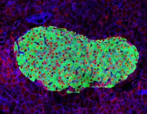 Imagen microscópica de una célula pancreática