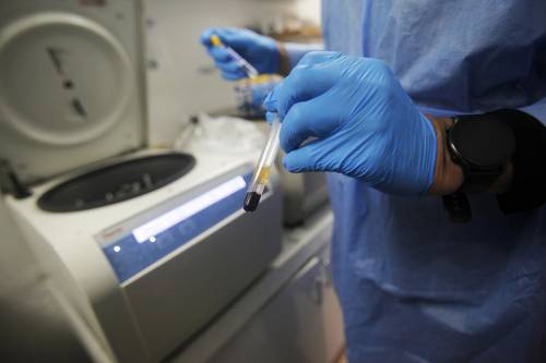 Fotografía de archivo de un laboratorista al manipular una muestra para un examen de VIH. 