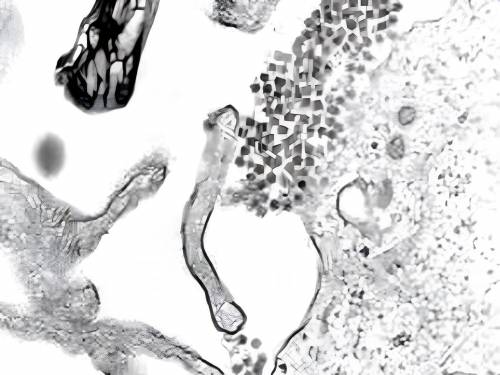 Partículas virales del dengue